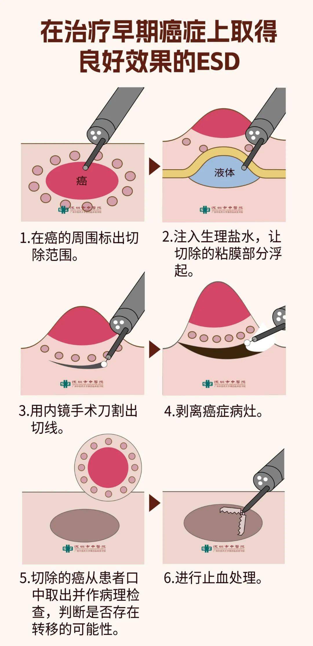 gho与esd的区别 esd文件和gho文件一样吗 